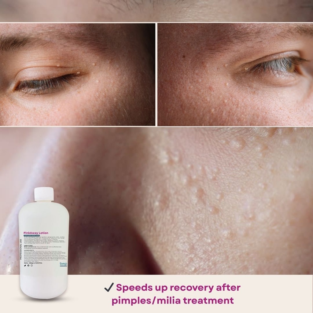 BWP PinkAway Lotion